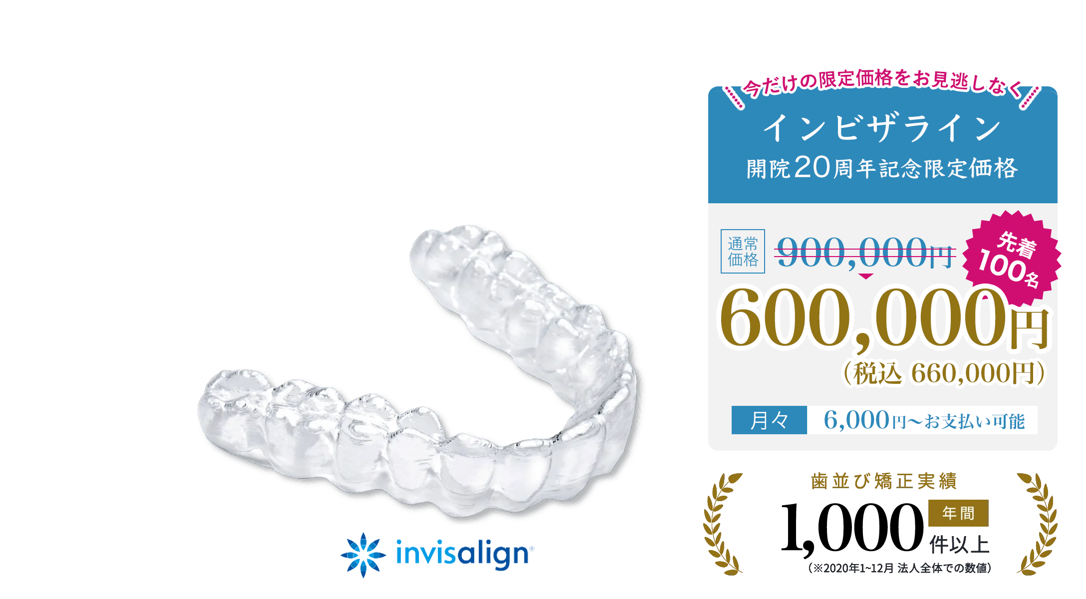 透明なマウスピース矯正（インビザライン）