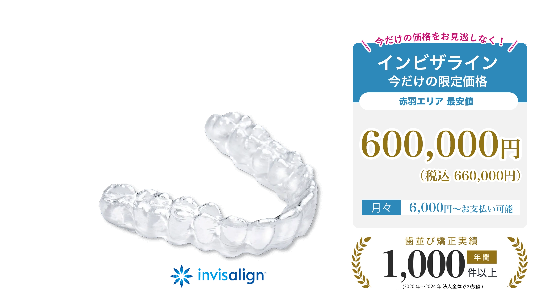 透明なマウスピース矯正（インビザライン）